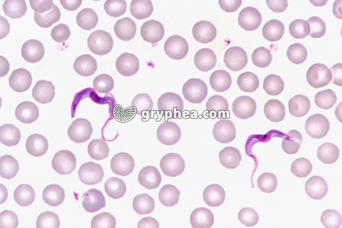 Trypanosomes dans le sang - Trypanosoma gambiense x200 - gryphea.com